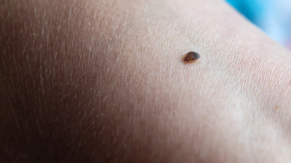 PRODUCTION - 23 June 2021, Lower Saxony, Delmenhorst: A bedbug bites an arm. Bed bugs are not at all uncommon. The bloodsuckers are nocturnal and masters at hiding, but bed bug sniffing dogs detect the insects. Photo: Sina Schuldt/dpa /DPA/PIXSELL