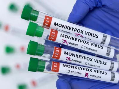 FILE PHOTO: Test tubes labelled "Monkeypox virus positive and negative" are seen in this illustration taken May 23, 2022. REUTERS/Dado Ruvic/Illustration/File Photo