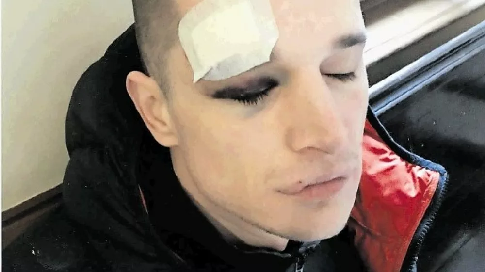 Klemen Rajnar trdi, da so ga policisti ob aretaciji poškodovali in nato zaslišali, ne da bi prej poklicali zdravnika in odvetnika.