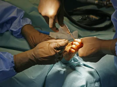 - 23.03.2015 - Ortopedska klinika UKC v Ljubljani - Oddelek za artroskopijo in pokodbe pri portu - operacija nonega palca (haluks valgus), - operacijska dvorana - - kirurki operativni poseg - zdravstvo //FOTO: Toma Skale