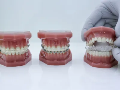 - simbolična fotografija - stomatologija - dentalna medicina - estetsko zobozdravstvo - ortodontija - ortodontski aparat za ravnanje zob - zobna proteza - zobotehnik - <br><br><br><br> //FOTO: Jaka Gasar