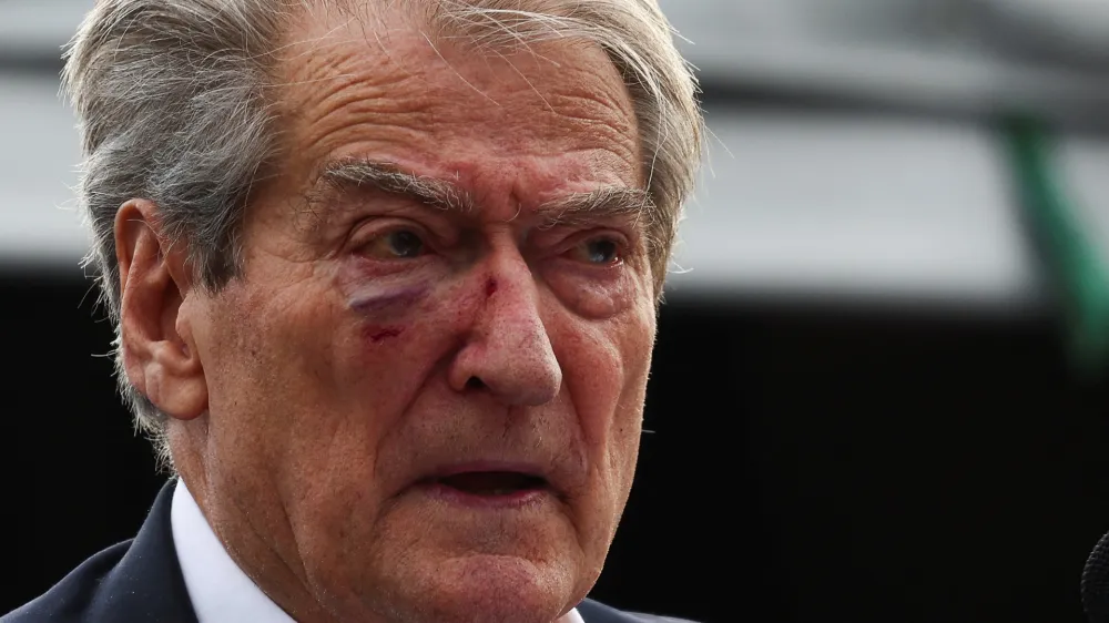 Albania's opposition Democratic Party leader Sali Berisha reacts after being punched in the face by a protestor, as the EU-Western Balkans summit takes place in Tirana, Albania, December 6, 2022. REUTERS/Florion Goga