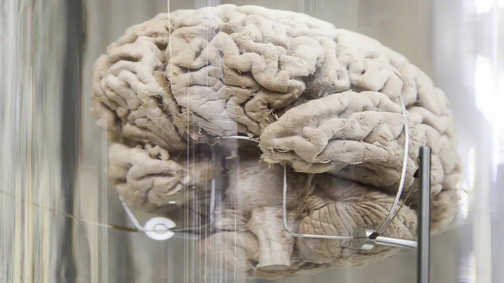 ﻿Human brain, detail of a human organ, intelligence and thought