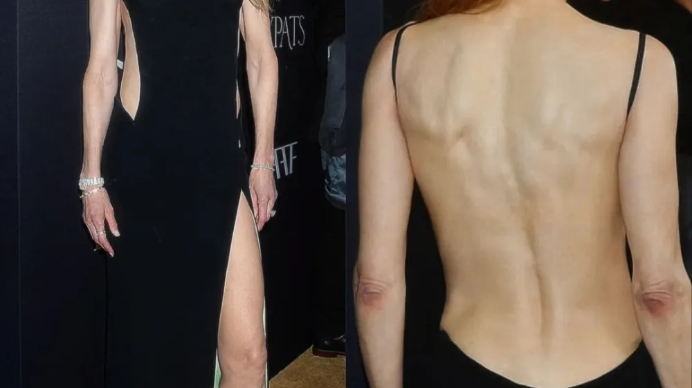 Drzna Nicole Kidman F Versace