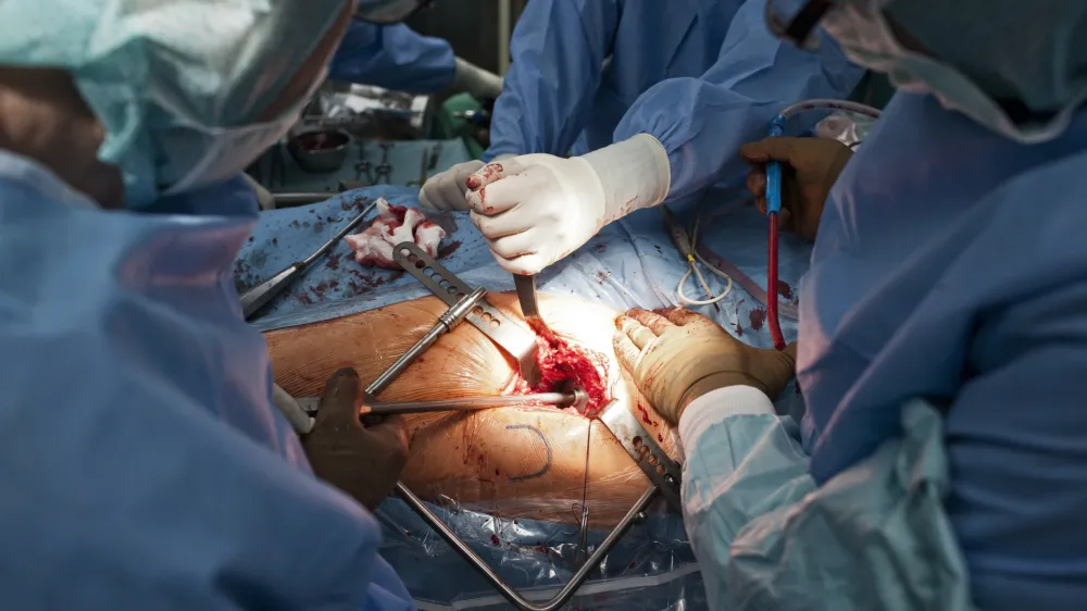 Operacija kolka, dr. Rasto Stok in dr. Peter PavlovÄŤiÄŤFOTO: JAKA GASAR / NEDELJSKI