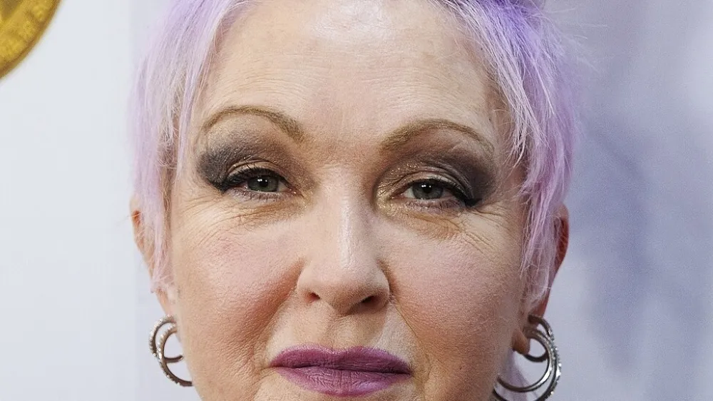 Cyndi Lauper