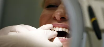Slovenske oblasti so si pri odpravljanju amalgama v zobozdravstvu izposlovale odlog, a so širitve pravice do belih zalivk kljub temu povod za nove spore. Foto: Bojan Velikonja 