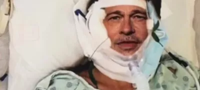 ''Brad Pitt'' okreva po operaciji. Vir: Mail Online