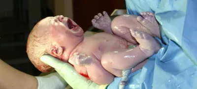 novorojenček, pokovnica, popkovnična kri, porod