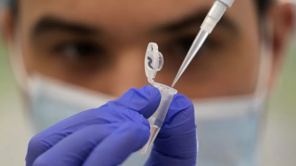 FILE - Research assistant Robert demonstrates how to prepare a sample for sequencing at the Wellcome Sanger Institute, Genome Campus, Hinxton, Cambridgeshire, England, Friday, on Jan. 7, 2022. After dropping most coronavirus restrictions in February 2022, Britain is now ending some COVID-19 testing and monitoring programs, a move some scientists fear will complicate efforts to track the virus and detect worrisome new variants. (AP Photo/Frank Augstein, File)