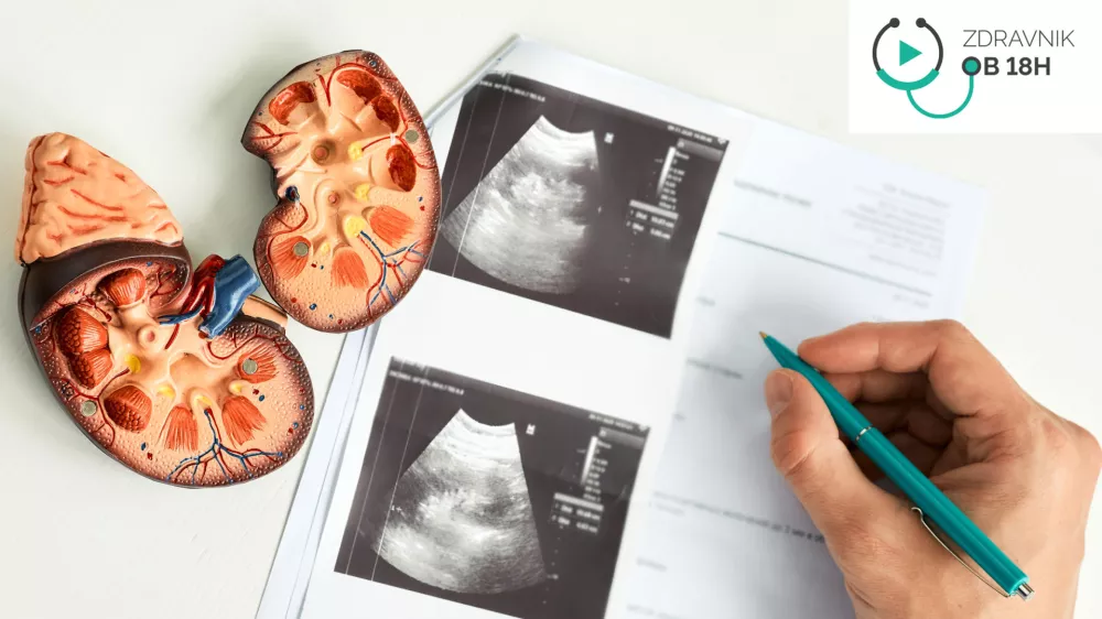 Na voljo imamo tudi laboratorijske teste za ugotavljanje kronične ledvične bolezni. (Foto: Getty Images)