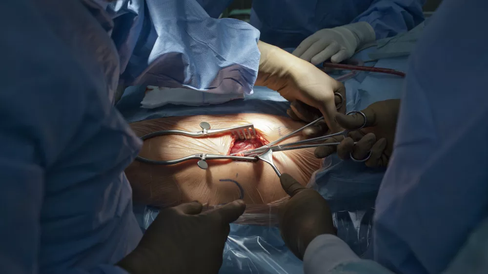 Operacija kolka, dr. Rasto Stok in dr. Peter PavlovÄŤiÄŤFOTO: JAKA GASAR / NEDELJSKI