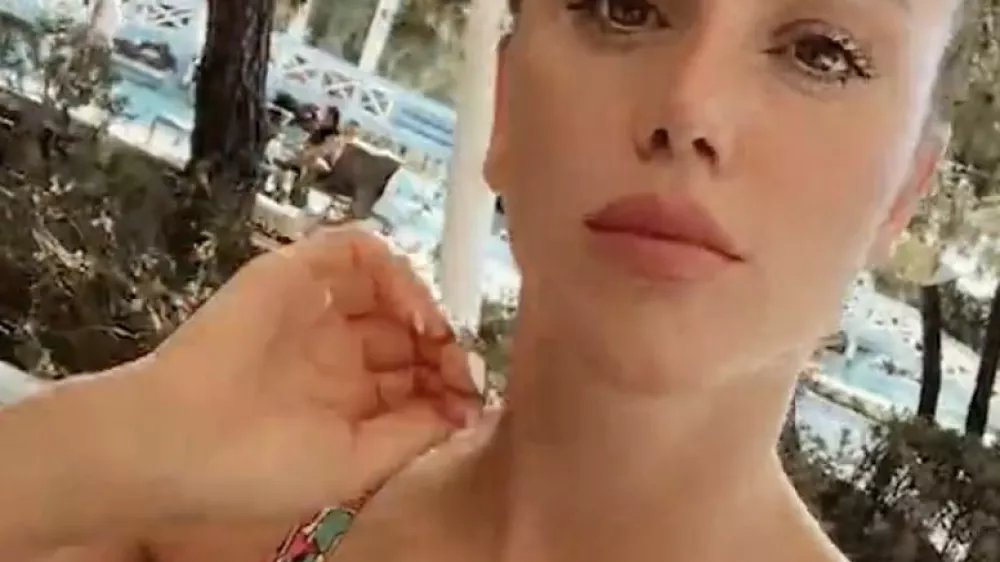 Güler Erdogan naj bi padla z nadvoza na avtocesto med poskusom bega pred policijo, ki jo je ustavila zaradi suma vožnje pod vplivom alkohola. F instagram