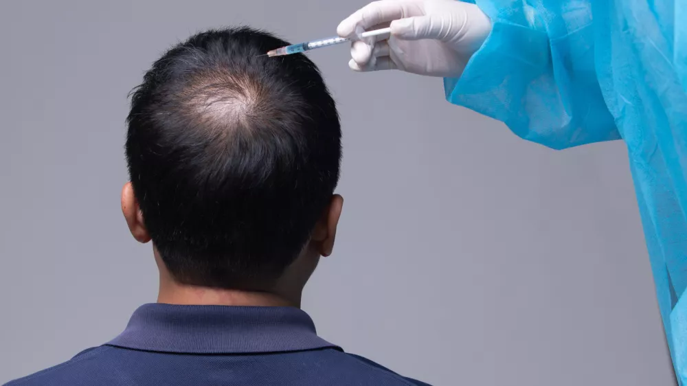 Aesthetics Doctor inject treatment serum vitamins to hair fall area on head by Syringe, Short Hair Loss control therapy clinic to prevent falling in working senior man woman, studio lighting isolated / Foto: Jadethaicatwalk