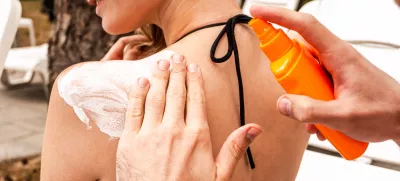 Cropped photo of a male hands squeezing a white sunscreen lotion from the plastic bottle to the woman back skin / Foto: Nataliya Dmytrenko