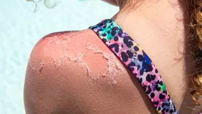 Slika je simbolična. / Foto: Istock