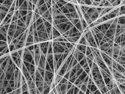 Ferrari Press Agency Thinnest pasta 1 Ref 1633922/11/2024See Ferrari textPicture MUST credit: Beatrice Britton / Adam Clancy / UCLThe world's thinnest spaghetti, 200 times less thick than a human hair, has been created by researchers.The stringy pasta favourite is not intended to be a new food but was created because of the wide-ranging uses that extremely thin strands of material, called nanofibers, have in medicine and industry.Nanofibers made of starch – produced by most green plants to store excess glucose – are especially promising and could be used in bandages to aid wound healing, as scaffolding for bone regeneration and for drug delivery. However, they rely on starch being extracted from plant cells and purified, a process requiring much energy and water.A more environmentally friendly method, the researchers say, is to create nanofibers directly from a starch-rich ingredient like flour, which is the basis for pasta.The team from the UK's University College London (UCL) made spaghetti just 372 nanometres, billionths of a metre, across using a technique called electrospinning.Threads of flour and liquid are pulled through the tip of a needle by an electric charge. The work was performed by chemistry master degree student Beatrice Britton.OPS: The world's thinnest spaghetti. Each individual strand is too narrow to be clearly captured by any form of visible light camera or microscope, so the team used a scanning electron microscope.Picture supplied by Ferrari,Fotografija:937537261, Licenca:Rights-managed, Omejitve:, Model izdaje:no