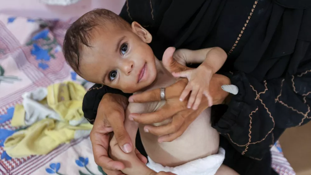 Seela Barbakh, an 11-month-old Palestinian girl who is malnourished, according to medics, is held by her mother, Najah, at Nasser Hospital in Khan Younis, in the southern Gaza Strip, July 23, 2025. REUTERS/Ramadan Abed