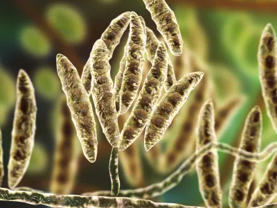 Glivične bolezni pod mikroskopom. Slika je simbolična. / Foto: Istock