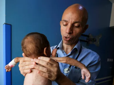 Palestinian doctor Ahmed Basal examines a child for malnutrition at Al-Rantisi Hospital in Gaza City, August 7, 2025. REUTERS/Dawoud Abu Alkas   TPX IMAGES OF THE DAY