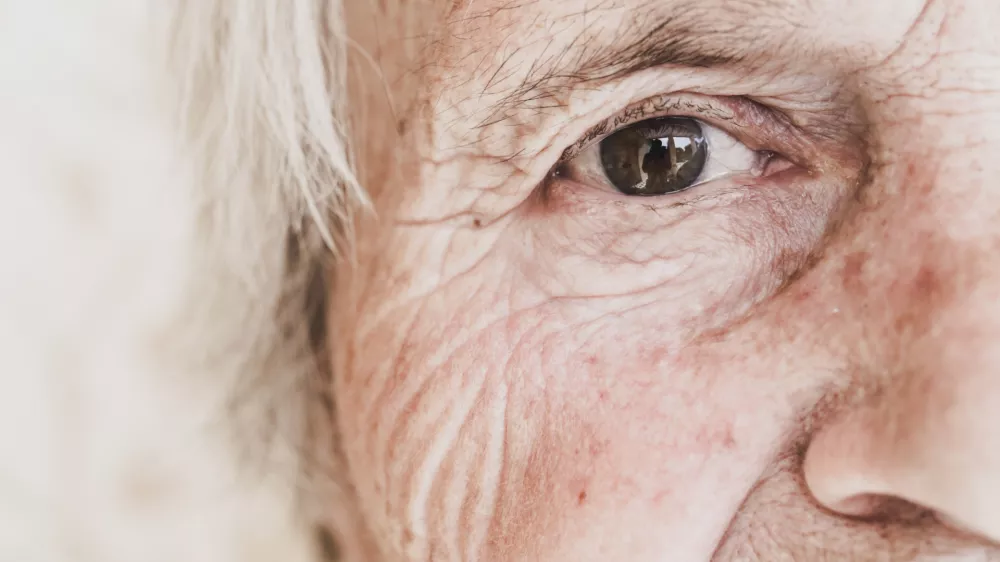 Čas se na vsakem od nas kaže nekoliko drugače. / Foto: Istock