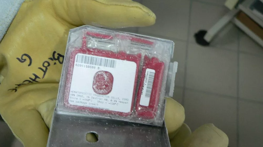 zamrznjene matične celice