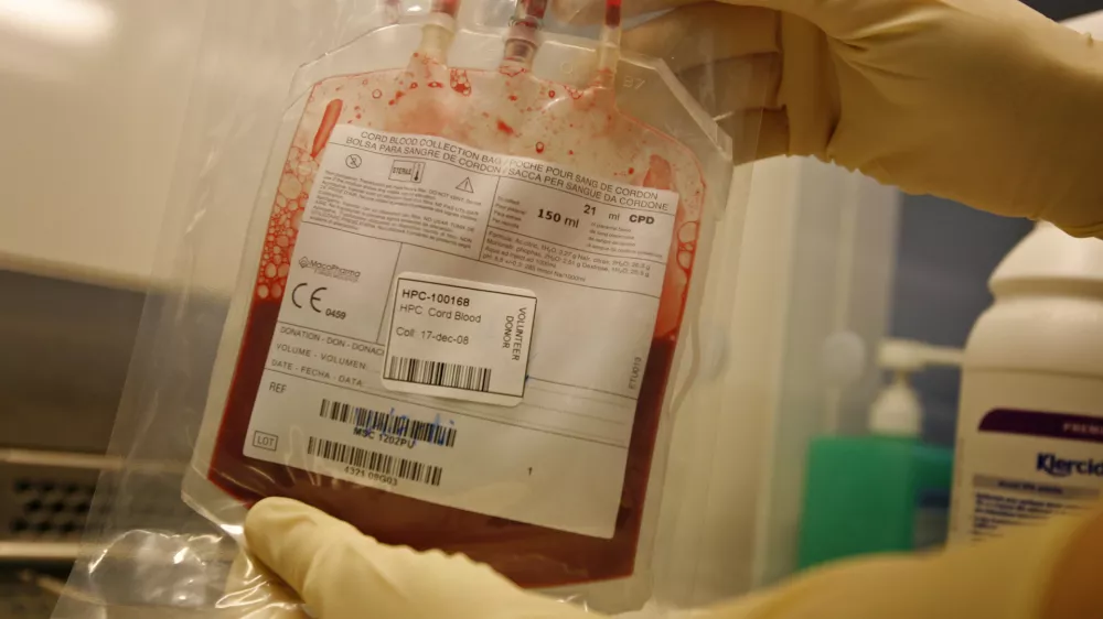 Matične celice iz popkovnice - matične celice iz popkovnične krvi imajo velik potencial za zdravljenje bolezni v prihodnosti - nastanejo ob spočetju in so temelj življenja - to so nerazvite osnovne celice, ki se lahko pod določenimi pogoji razvijejo v katerokoli celico, npr. v mišice, živčevje ali drugo tkivo v telesu. Nekatere pa se ne specializirajo, temveč opravljajo nalogo regeneracije tkiva.- Zavod RS za transfuzijsko medicino - //FOTO: Matej PovšeOPOMBA: ZA OBJAVO V ČASOPISU DNEVNIK