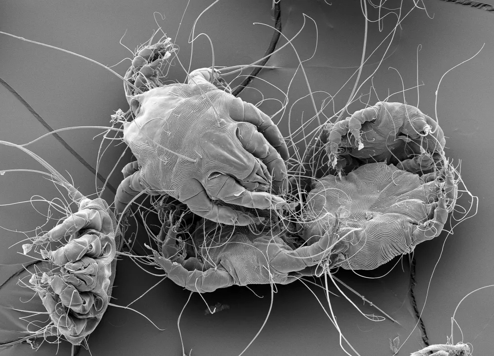 Dust mites. Black and white scanning electron micrograph (SEM) of house dust mites (Dermatophagoides pteronyssinus). Millions of dust mites inhabit the home, feeding on shed skin cells. They mainly live in furniture, and are usually harmless. However, their excrement and dead bodies may cause allergic reactions in susceptible people. The dust mite life cycle from egg to adult takes approximately one month to complete, mature female mites can lay from 1-2 eggs per day. Adult mites can live up to two months. Magnification: x60 when printed at 10 centimetres wide.,Image: 982316203, License: Royalty-free, Restrictions:, Model Release: no / Foto: Profimedia