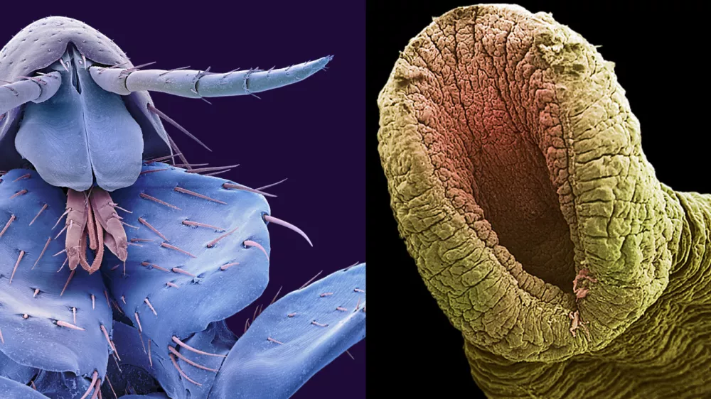 Paraziti od blizu / Foto: Profimedia