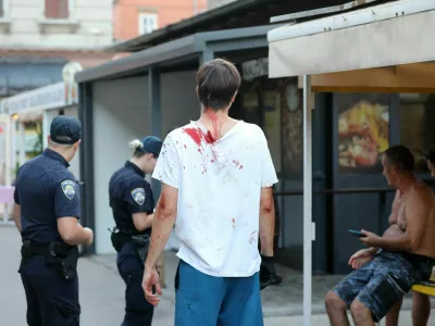 Priče so poročale o udarcih v glavo, glasnik krikih in prelivanju krvi, po pisanju hrvaških medijev pa naj bi eden od pretepačev segel celo po pištoli za žeblje. 