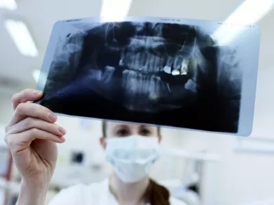 Ortopanska slika- Stomatološka klinika UKC Ljubljana - zobozdravstvo//FOTO: Jaka Adamič