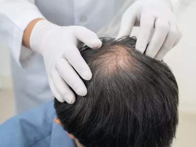 Zdravniški pregled lasišča / Foto: Istock