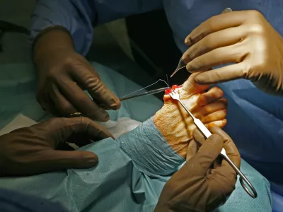 Prestavljanje zdravljenj: Dnevno je neizkoriščenih več kot 300 terminov