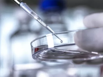 Simbolična fotografija: Profimedia