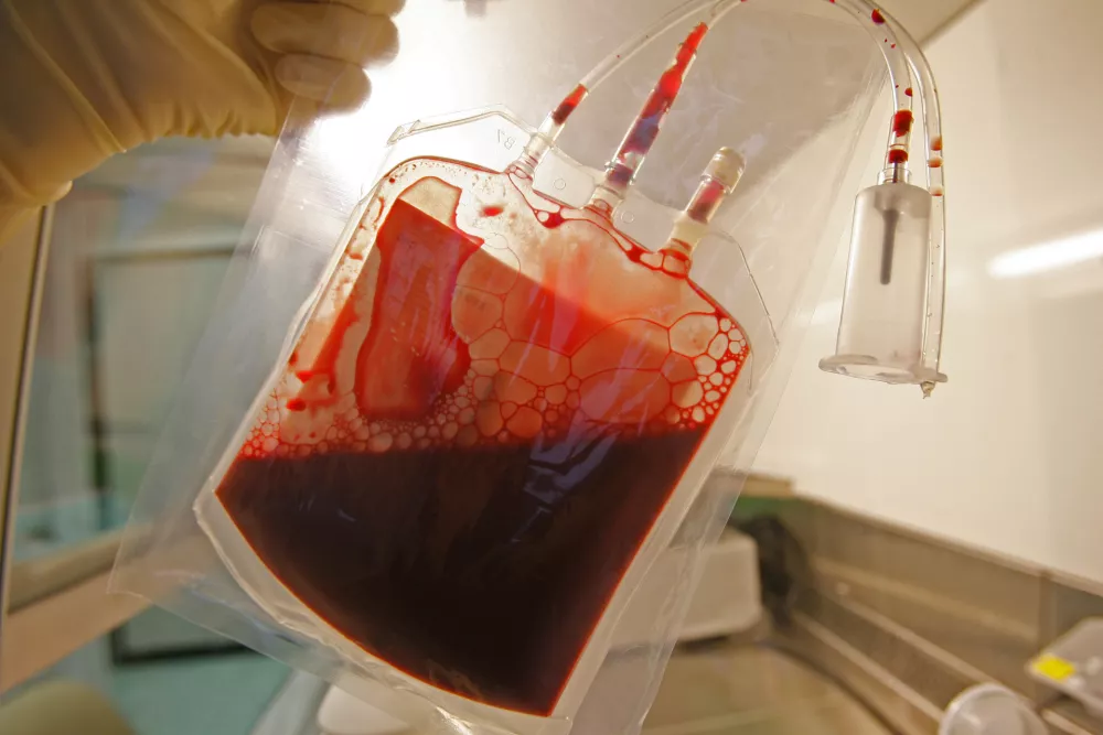 Matične celice iz popkovnice - matične celice iz popkovnične krvi imajo velik potencial za zdravljenje bolezni v prihodnosti - nastanejo ob spočetju in so temelj življenja - to so nerazvite osnovne celice, ki se lahko pod določenimi pogoji razvijejo v katerokoli celico, npr. v mišice, živčevje ali drugo tkivo v telesu. Nekatere pa se ne specializirajo, temveč opravljajo nalogo regeneracije tkiva.- Zavod RS za transfuzijsko medicino - //FOTO: Matej PovšeOPOMBA: ZA OBJAVO V ČASOPISU DNEVNIK / Foto: Matej Povše