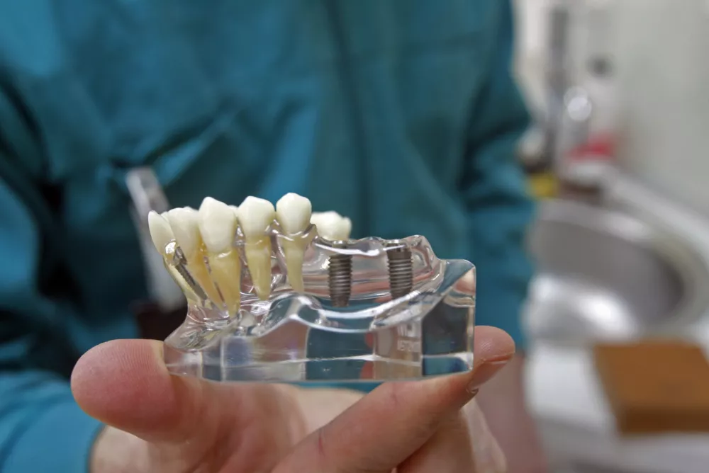 H-Dent Stomatološka ordinacija Habijanec- Hrvaška 2012 - Rovinj - dentalni turizem - popravilo zob - cenejši zobozdravniki na hrvaškem - //FOTO: Bojan Velikonja OPOMBA: ZA OBJAVO V PRILOGI – DNEVNIKOV OBJEKTIV - REPORTAŽA 2012