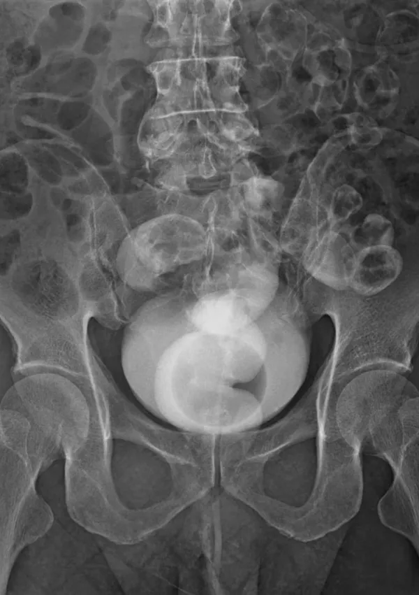 Rentgenska (simbolična) slika / Foto: Istock