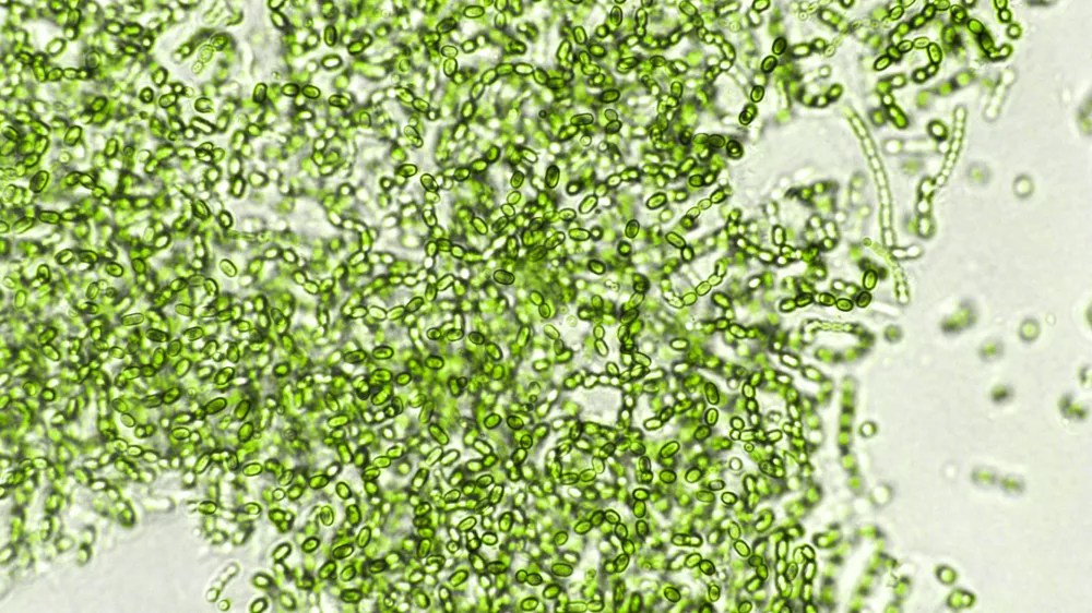 Probiotične bakterije pod mikroskopom / Foto: Istock