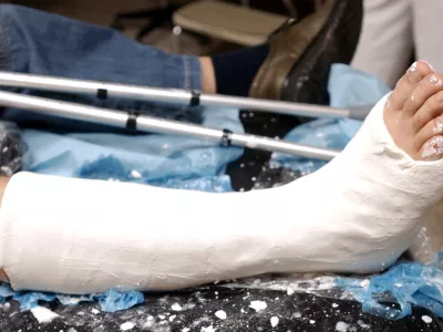 Bolniška odsotnost: Kako bo videti laični nadzor in kaj skrbi detektive?