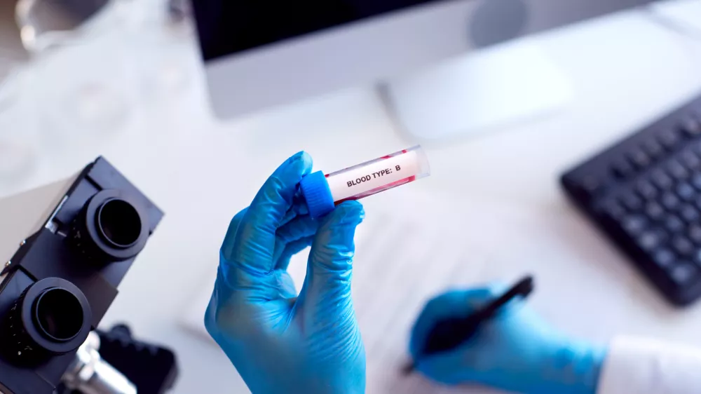 Kri ima, kot kaže, precej veliko vlogo pri mnogih boleznih. / Foto: Istock