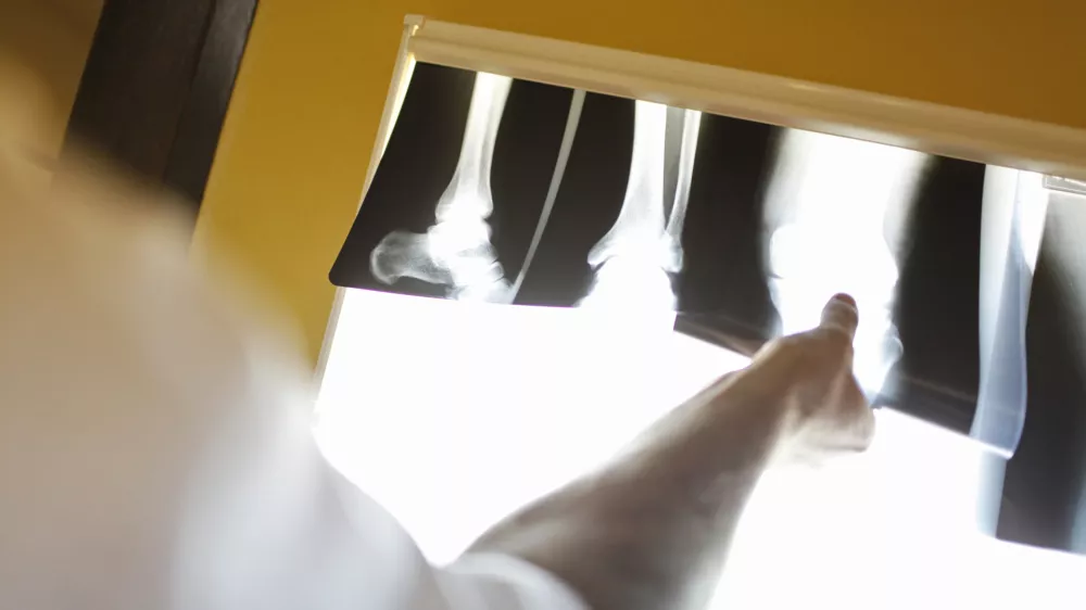 Urgenca UKC - Urgentni kirurški blok  - simbolična fotografija - zdravstvo - zdravniki -  ///FOTO: Luka Cjuha///FOTO: Luka Cjuha