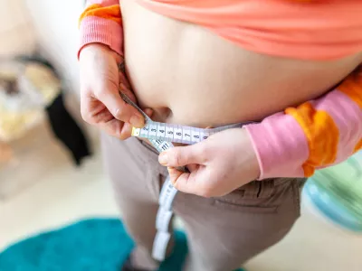 Smernice debelost nedvoumno opredeljujejo kot kronično bolezen in ne kot posledico pomanjkanja volje / Foto: Getty Images