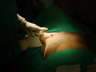 lepotna kirurgija, Glumičič Medical Group - lepotna kirurgija, Siniša Glumičič