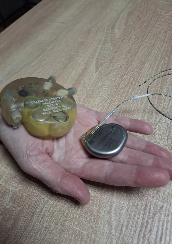 Srčni spodbujevalnik nekoč in danes / Foto: Meta Černoga