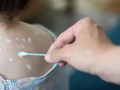 / Foto: Getty Images