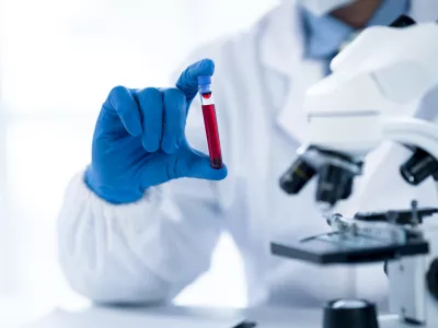 Doctor hand taking a blood sample tube from a rack with machines of analysis in the lab background, Technician holding blood tube test in the research laboratory. / Foto: Perawit Boonchu