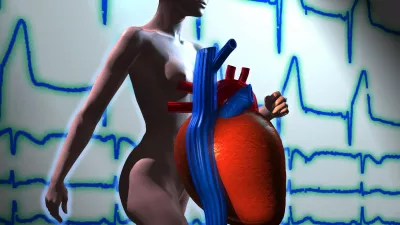 srce, infarkt, ilustracija