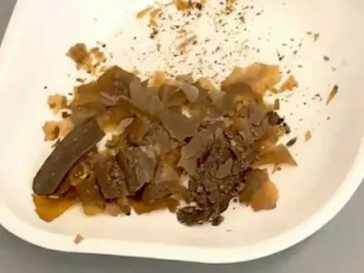 Vzorce blata so na&scaron;li v starih steklenih posodicah. Foto: