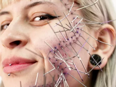 80 igel v eni seansi: Ekstremna umetnost 28-letnice, ki je vadila na sebi