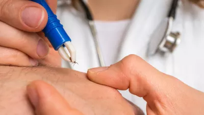 Female doctor removing a tick with tweezers from hand of patient. Encephalitis, borreliosis and lyme disease. / Foto: Andriano_cz Getty Images